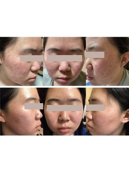 お肌をきれいにしたい