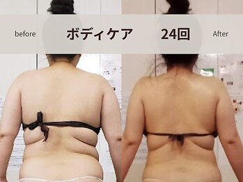 イクヨノ ビューティーサロン(194's beauty salon)/美整メイクマジック全身ボディ術