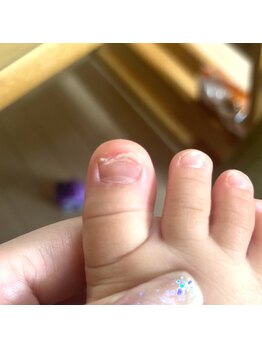 リネイル 長浜(Re-na-iL)/ネイルケア＆スパ¥7000