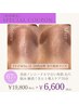 【毛穴・くすみ改善】肌診断付!! 肌活性・透明感UP 70分¥6,600
