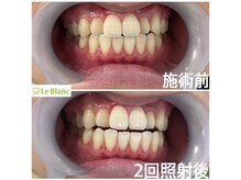 ルブラン 奈良店(Le Blanc)/効果抜群でリーズナブル！！