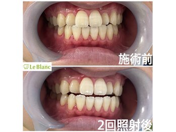 ルブラン 奈良店(Le Blanc)/効果抜群でリーズナブル!!