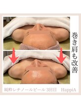 ハピア(HappiA)/純粋レチノールピール