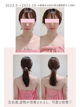 トゥインクル 麻布(twinkle)/麻布十番/シンメトリー小顔矯正