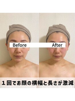 お顔の研究所/ビフォーアフター写真♪