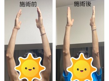 ジェネ鍼灸院/リハビリの総仕上げにどうぞ