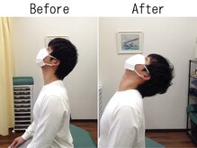 ライズ整体院/【猫背・スマホ首・骨盤矯正】