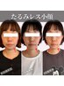 【30歳代の方迷ったらこれ!】 小顔集中改善コースお試し 約75-90分