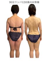 エスエー(SA)/Before/after