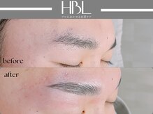 アポロ(Apollo)/ハリウッドブロウリフト