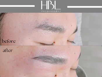 アポロ(Apollo)/ハリウッドブロウリフト