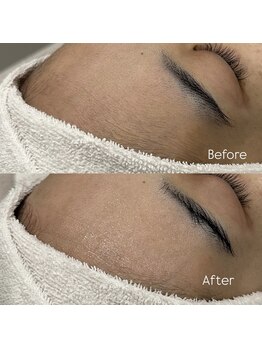 ウィール 栄 矢場町店(WE:LL)/美肌Wax