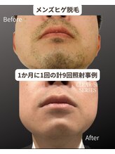 マウム(Maum)/清潔感溢れる肌へ