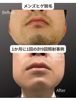 マウム(Maum)/清潔感溢れる肌へ