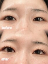 アイモア 吉祥寺店(eye mor.)/まつげパーマ/美眉/アイブロウ