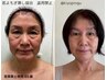 【初回体験★更年期のお悩み・髪のお悩みに】増毛￥16,500→￥15,950