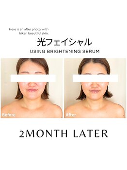 ハグミー 甲子園口(HUGME.)の写真/人気が止まらない！日常の新常識★【大人気!韓国ツヤ肌光フェイシャル￥3600】若見えの光★