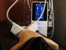 【最新AI機能付360℃脂肪冷却】確実に脂肪細胞20%減!お試しお腹1カップ9900