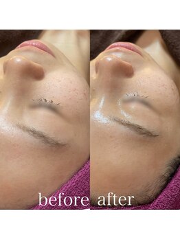 ビエン(bien)/誰もが憧れるバブみ肌