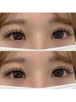 バニーアイズ 天神(Bunny eyes TENJIN)/LEDフラットマットラッシュ160本