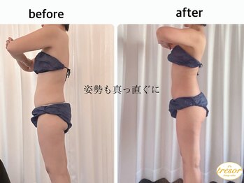 トレゾール(tresor)/★痩身★赤坂痩身エステ