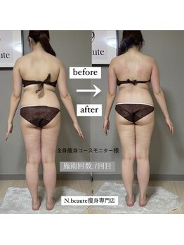 エヌボーテ(N. beaute)/全身痩身4回モニターコース