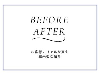 エステ ニキビケア研究所 川崎店/BEFORE AFTER