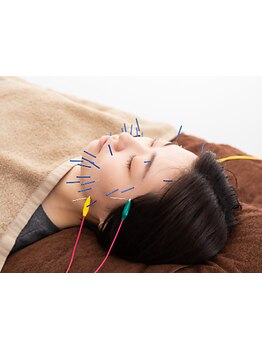 鍼灸施術を受けたい