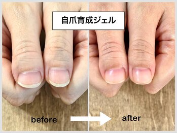 コバコ(kobaco)/自爪育成ジェル　before→ after