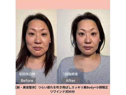 フェルナ(FERNA)の写真