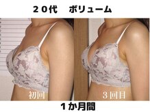 バストサロン メルベイユ(Merveile)/ボリュームUPしブラ隙間が埋まる