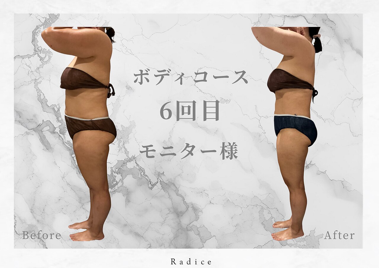 ラディス(Radice)｜ホットペッパービューティー