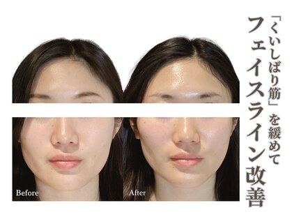 ベラ 東京院(Bella)の写真