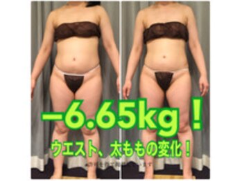 ボディエステティック アクアオーラ 富山店/-6.65キロ！体型の変化！