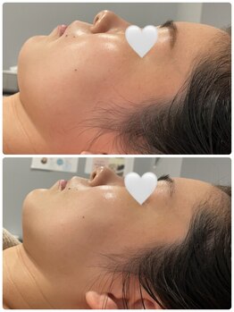 ジョアアンジェ 京橋店(joie ange)/シルクでトーンアップ！