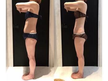 リボディ 表参道(An re Body)/before→after