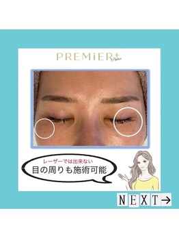 プルミエプラス 恵比寿店(PREMiER+)/【恵比寿/渋谷/シミケア】