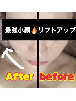 ディオーネ(Dione)/小顔マッサージで無敵小顔!