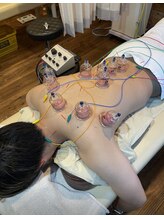 エスポワール 中野鍼灸院×整骨院(Espoir)/電気鍼×カッピング
