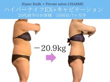 シャルム(charme)/最強ハイパーナイフEX痩身