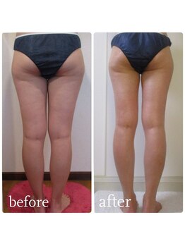 加圧ビューティーサロン スタイル エム(beauty salon style M)/30代/パワーツリー120分のみ