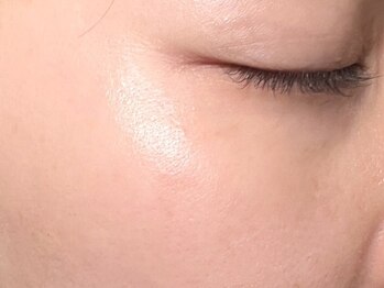 ピレア(Pillea)の写真/【静岡希少のエステサロン☆】お肌に関するお悩みはプロにお任せ下さい！[毛穴/シミ/シワ/たるみ改善]