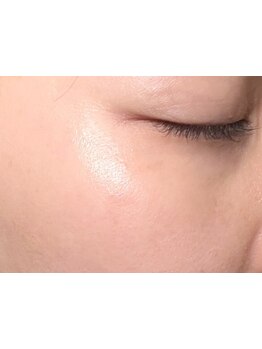 お肌をきれいにしたい