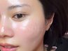 【ベビースキン】赤ちゃん肌を目指したい方におすすめ
