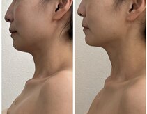 リュウ鍼灸院 サロン ド リュウ(Salon de Ryu)