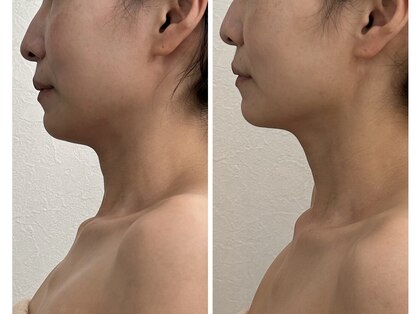 リュウ鍼灸院 サロン ド リュウ(Salon de Ryu)の写真