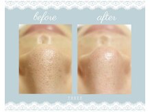 スリー(THREE)/毛穴を気にしている方必見！