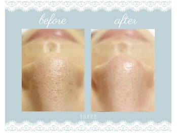 スリー(THREE)/毛穴を気にしている方必見!