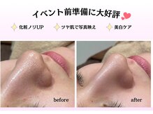 エステティック レイビス 川崎店(RAYVIS)/