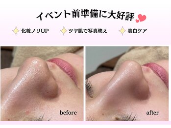 エステティック レイビス 川崎店(RAYVIS)/